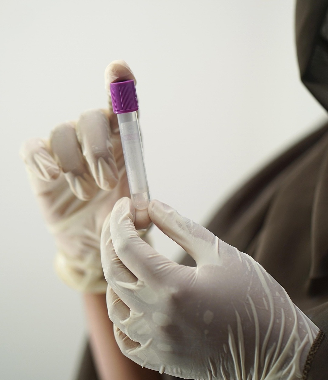 blood-test-5601437_1920 (2)