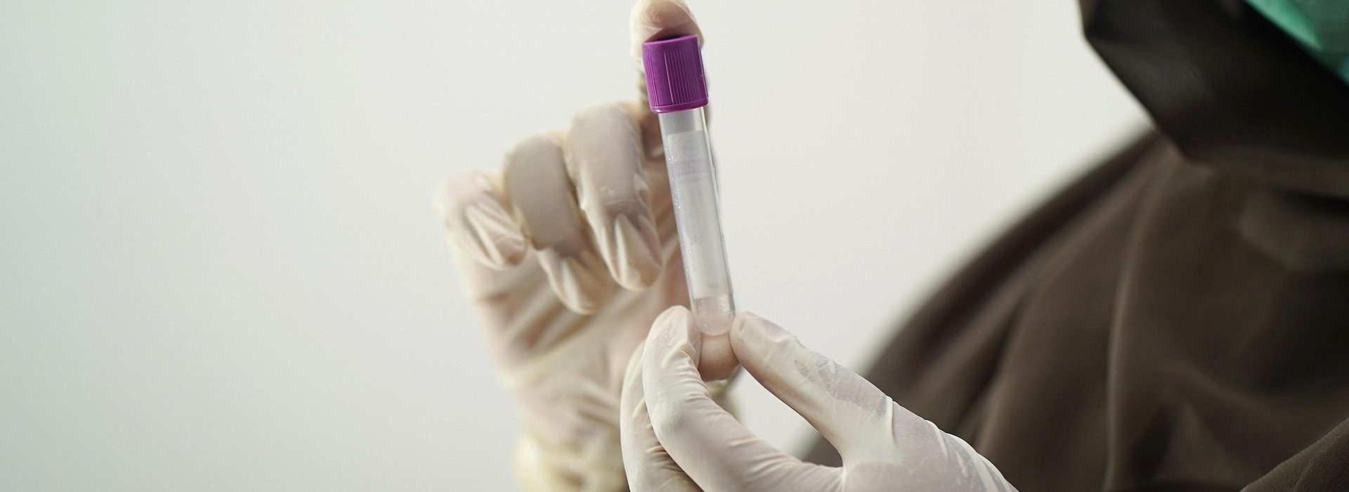 blood-test-5601437_1920 (1)